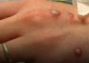 A Secretaria de Estado de Saude do Amazonas (SES-AM)